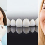 لمینیت دندان یا ونیر کامپوزیت؟ راهنمای کامل انتخاب بهترین روش لبخند زیبا